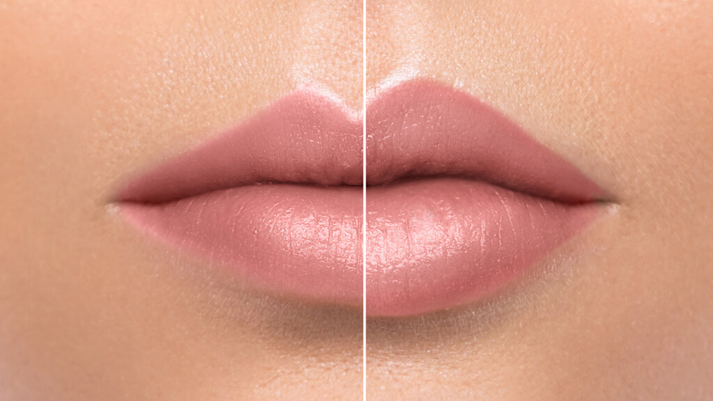 Lip 3-Peptide &#8211; bankietowy efekt dla najpiękniejszych ust